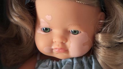   Muñeca con vitiligo es finalista a mejor juguete del año en premios TOTY 