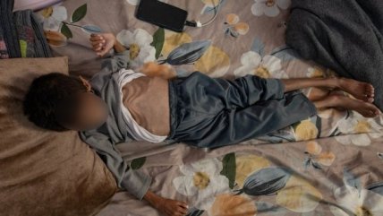  Crisis Humanitaria en Gaza: Más de 200 muertes por desnutrición  