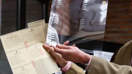   Elecciones: Servel presentó papeletas para personas con discapacidad 