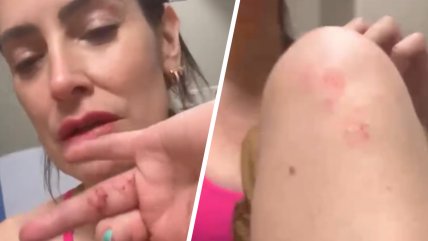  Adriana Barrientos sufrió violento portonazo en Las Condes  